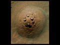 Marte anomalie 2014 - Stonehenge